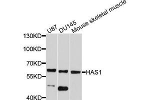 Western blot analysis of extracts of various cell lines, using HAS1 antibody (ABIN5997874) at 1/1000 dilution.