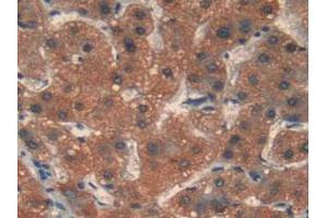 Figure. (MMP12 Antikörper  (AA 290-469))