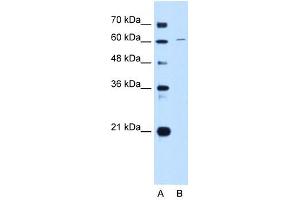 CDT1 antibody used at 1 ug/ml to detect target protein.