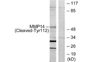 Western blot analysis of extracts from 293 cells, treated with etoposide (25uM, 1hour), using MMP14 (Cleaved-Tyr112) antibody. (MMP14 Antikörper  (Cleaved-Tyr112))