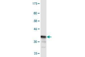 Western Blot detection against Immunogen (36. (CHST3 Antikörper  (AA 312-411))