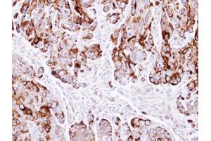 IHC-P Image Immunohistochemical analysis of paraffin-embedded HT29 xenograft , using Cytokeratin 20, antibody at 1:500 dilution. (KRT20 Antikörper  (C-Term))