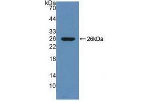 Detection of Recombinant ZPI, Rat using Polyclonal Antibody to Serpin A10 (SERPINA10) (SERPINA10 Antikörper  (AA 278-425))
