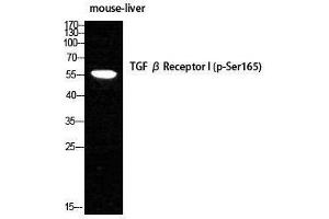 Western Blotting (WB) image for anti-Transforming Growth Factor, beta Receptor 1 (TGFBR1) (pSer165) antibody (ABIN3180463)