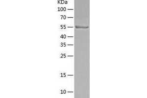 Western Blotting (WB) image for Interferon Regulatory Factor 5 (IRF5) (AA 1-498) protein (His tag) (ABIN7123499)