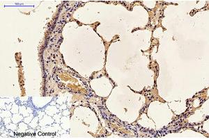 Immunohistochemical analysis of paraffin-embedded rat lung tissue. (Caspase 9 Antikörper)