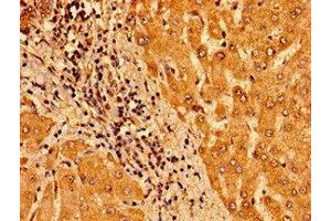 Immunohistochemistry of paraffin-embedded human liver tissue using ABIN7172938 at dilution of 1:100