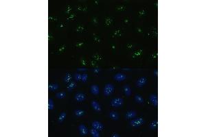 Immunofluorescence analysis of U-2 OS cells using NOLC1 antibody (ABIN6130597, ABIN6144708, ABIN6144709 and ABIN6221608) at dilution of 1:100. (NOLC1 Antikörper  (AA 400-699))