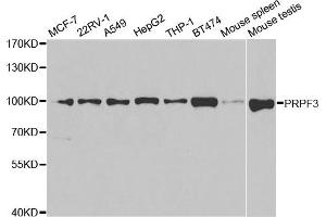 Western Blotting (WB) image for anti-PRP3 Pre-mRNA Processing Factor 3 Homolog (PRPF3) antibody (ABIN1876670) (PRPF3 Antikörper)