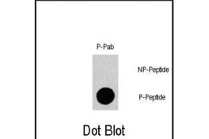 Dot blot analysis of Phospho-Gab1- polyclonal antibody (Cat.