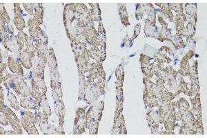 Immunohistochemistry of paraffin-embedded Rat heart using CD59 Polyclonal Antibody at dilution of 1:100 (40x lens). (CD59 Antikörper)