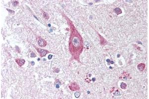 Human Brain, Cortex (formalin-fixed, paraffin-embedded) stained with ICOSLG antibody ABIN294881 at 1:50 followed by biotinylated anti-mouse IgG secondary antibody ABIN481714, alkaline phosphatase-streptavidin and chromogen. (ICOSLG Antikörper)