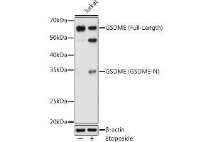 Western blot analysis of extracts of Jurkat cells, using GSDME antibody (ABIN6127757, ABIN6139554, ABIN6139555 and ABIN6223304) at 1:1000 dilution. (Non-Syndromic Hearing Impairment Protein 5 (GSDME) (AA 1-260) Antikörper)