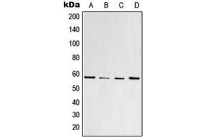 Western blot analysis of PPAR gamma (pS112) expression in HeLa colchicine-treated (A), Raw264. (PPARG Antikörper  (pSer112))