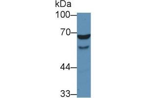 Detection of WASP in Human HL60 cell lysate using Polyclonal Antibody to Wiskott Aldrich Syndrome Protein (WASP) (WASP Antikörper  (AA 39-251))