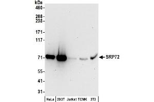 anti-Signal Recognition Particle 72kDa (SRP72) (AA 621-671) antibody