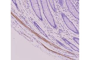 Immunohistochemistry (IHC) image for anti-Tubulin, beta 2B (TUBB2B) antibody (ABIN567611) (TUBB2B Antikörper)