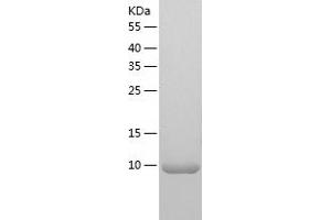 UBE2J2 Protein (AA 124-224) (His tag)