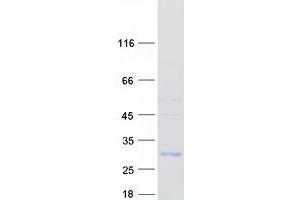 UBTD1 Protein (Myc-DYKDDDDK Tag)