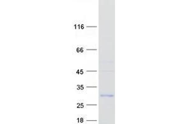UBTD1 Protein (Myc-DYKDDDDK Tag)