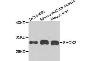 Western blot analysis of extracts of various cell lines, using SHOX2 antibody. (SHOX2 Antikörper)