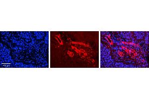 Rabbit Anti-GGPS1 Antibody     Formalin Fixed Paraffin Embedded Tissue: Human Pineal Tissue  Observed Staining: Cytoplasmic in endothelial cells in blood vessels  Primary Antibody Concentration: 1:100  Other Working Concentrations: 1/600  Secondary Antibody: Donkey anti-Rabbit-Cy3  Secondary Antibody Concentration: 1:200  Magnification: 20X  Exposure Time: 0. (GGPS1 Antikörper  (Middle Region))