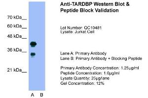 Western Blotting (WB) image for anti-TAR DNA Binding Protein (TARDBP) (C-Term) antibody (ABIN2780849)