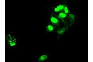 Image no. 2 for anti-SATB Homeobox 1 (SATB1) antibody (ABIN1500811)