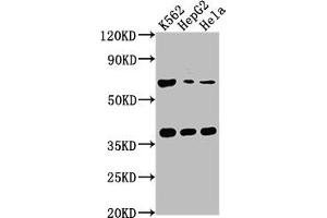 Western Blot Positive WB detected in: K562 whole cell lysate, HepG2 whole cell lysate, Hela whole cell lysate All lanes: CFHR5 antibody at 1:1000 Secondary Goat polyclonal to rabbit IgG at 1/50000 dilution Predicted band size: 65 kDa Observed band size: 65 kDa (CFHR5 Antikörper  (AA 374-569))