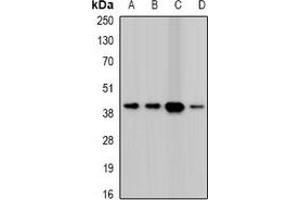 Western blot analysis of Twinfilin-2 expression in HepG2 (A), A431 (B), mouse heart (C), mouse spleen (D) whole cell lysates. (TWF2 Antikörper)