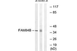 Western blot analysis of extracts from Jurkat/HuvEc cells, using FAM84B Antibody. (FAM84B Antikörper  (AA 11-60))