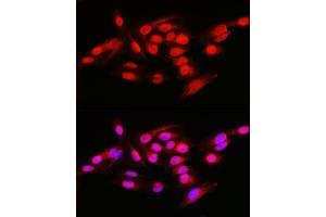 Immunofluorescence analysis of U2OS cells using NFKB1 Rabbit pAb (ABIN6130581, ABIN6144571, ABIN6144573 and ABIN7101802) at dilution of 1:50 (40x lens).