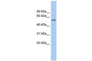 Image no. 1 for anti-Preferentially Expressed Antigen in Melanoma (PRAME) (N-Term) antibody (ABIN6743940) (PRAME Antikörper  (N-Term))