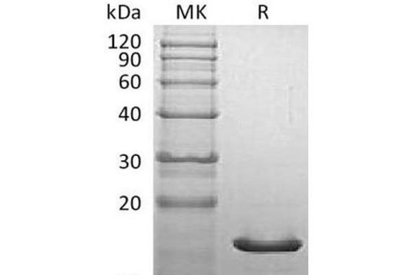 SNCA Protein