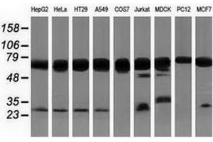 Western blot analysis of extracts (35 µg) from 9 different cell lines by using anti-PUS7 monoclonal antibody. (PUS7 Antikörper)