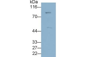 Detection of ANGPTL3 in HepG2 cell lysate using Polyclonal Antibody to Angiopoietin Like Protein 3 (ANGPTL3) (ANGPTL3 Antikörper  (AA 22-281))