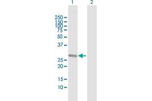 Western Blot analysis of RABL2B expression in transfected 293T cell line by RABL2B MaxPab polyclonal antibody. (RABL2B Antikörper  (AA 1-229))