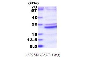 SDS-PAGE (SDS) image for B9 Protein Domain 2 (B9D2) (AA 1-175) protein (His tag) (ABIN6387463)