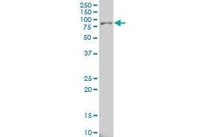 ALOX15 monoclonal antibody (M04), clone 3D8 Western Blot analysis of ALOX15 expression in Hela S3 NE .