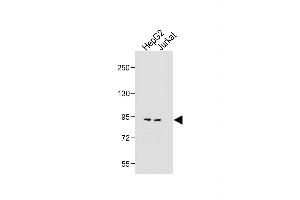 All lanes : Anti-MGAT5 Antibody (C-term) at 1:1000 dilution Lane 1: HepG2 whole cell lysate Lane 2: Jurkat whole cell lysate Lysates/proteins at 20 μg per lane.