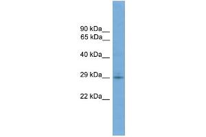 WB Suggested Anti-TMEM139 Antibody Titration: 0. (TMEM139 Antikörper  (N-Term))