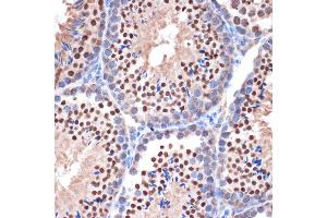 Immunohistochemistry (IHC) image for anti-Nucleoporin 153kDa (NUP153) antibody (ABIN1512527)