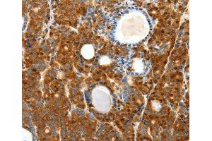 Immunohistochemistry (IHC) image for anti-Secretin Receptor (SCTR) antibody (ABIN3017416) (SCTR Antikörper)