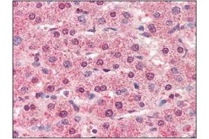 Immunohistochemistry (IHC) image for anti-Cathepsin L1 (CTSL1) (AA 114-333) antibody (ABIN317508) (Cathepsin L Antikörper  (AA 114-333))