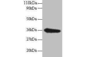 Western blot All lanes: TSTA3 antibody at 2 μg/mL + EC109 whole cell lysate Secondary Goat polyclonal to rabbit IgG at 1/15000 dilution Predicted band size: 36 kDa Observed band size: 36 kDa (TSTA3 Antikörper  (AA 1-314))