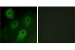 Immunofluorescence analysis of HeLa cells, using PKC delta (Ab-52) Antibody. (PKC delta Antikörper  (AA 18-67))