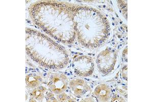 Immunohistochemistry of paraffin-embedded human stomach using CPM antibody (ABIN5975037) at dilution of 1/100 (40x lens). (CPM Antikörper)