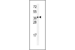 HARB1 Antibody (N-term) (ABIN655103 and ABIN2844735) western blot analysis in mouse bladder tissue lysates (35 μg/lane). (HARBI1 Antikörper  (N-Term))