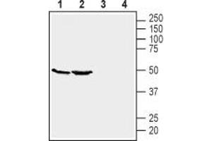 Western blot analysis of mouse kidney (lanes 1 and 3) and brain (lanes 2 and 4) lysates: - 1,2 Anti-GPR39 (extracellular) Antibody (ABIN7043159, ABIN7044429 and ABIN7044430), (1:200). (GPR39 Antikörper  (Extracellular))