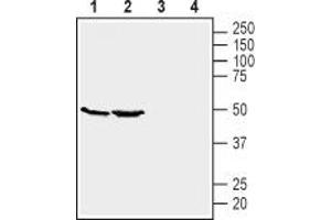 Western blot analysis of mouse kidney (lanes 1 and 3) and brain (lanes 2 and 4) lysates: - 1,2 Anti-GPR39 (extracellular) Antibody (ABIN7043159, ABIN7044429 and ABIN7044430), (1:200). (GPR39 Antikörper  (3rd Extracellular Loop))